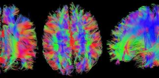 neuromarketing